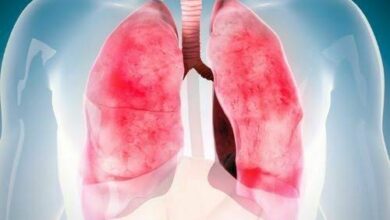 Akciğer kanseri belirtileri